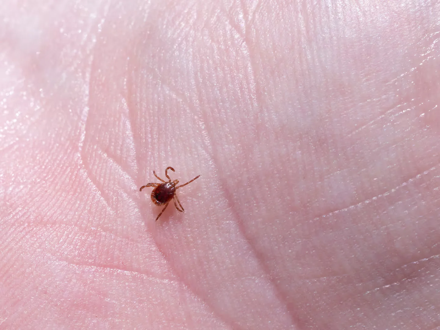 Tick-borne shield: vaccines, antibodies and pills on the horizon
