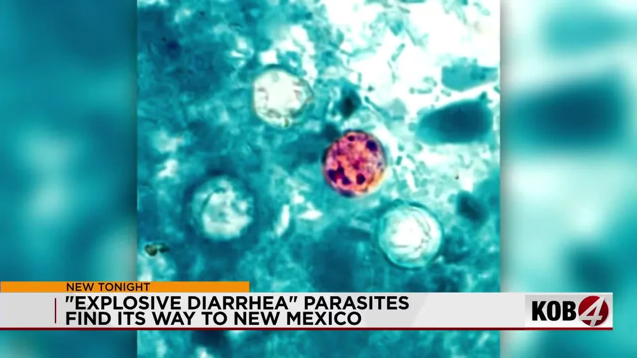 New Mexico Detects 3 Cyclospora Cases, Officials Urge Hand Hygiene