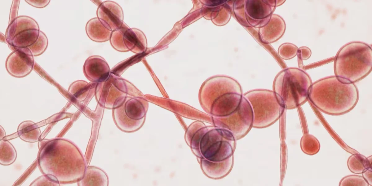 Michigan Confronts Surge of Drug-Resistant Candida Auris in Hospitals