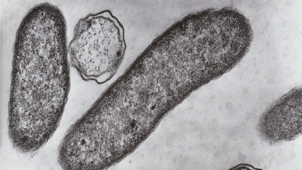 Florida Teen Fights Rare Flesh-Eating Bacteria After Park Swim