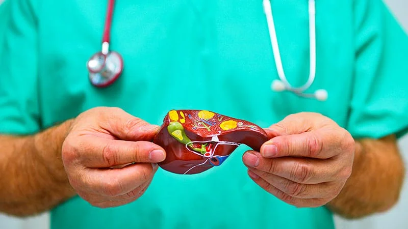 Fatty Liver Common in PMOS-Referred Young Women, Highlighting Screening Gaps