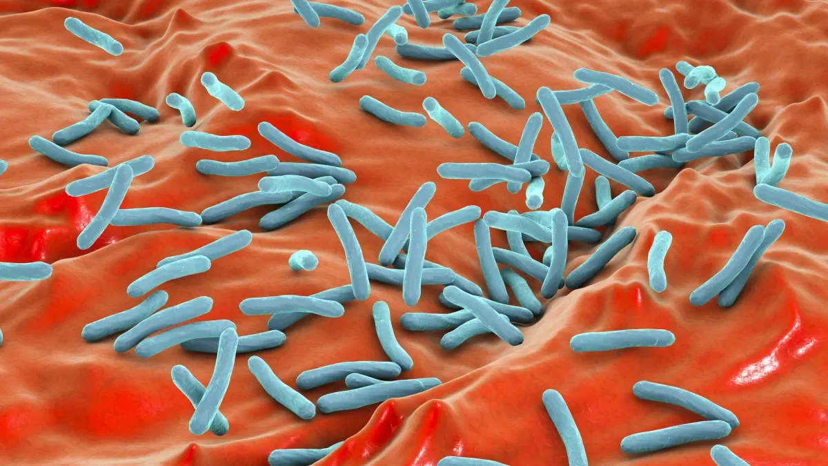 Possible MDR-TB exposure at CSU San Marcos campus and Sprinter prompts health alert