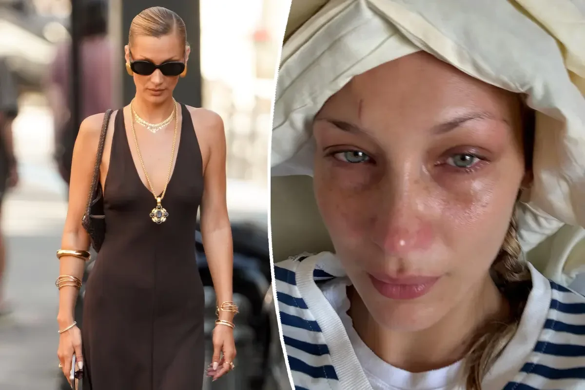 Bella Hadid breaks silence on Lyme-linked isolation and depression