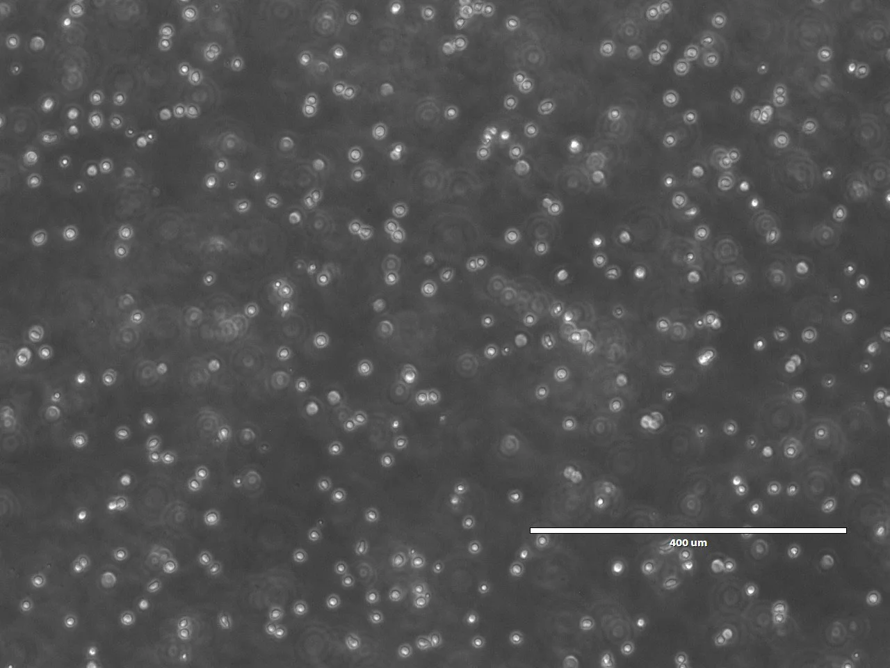 ISS Bioreactor Study Aims to Scale Up Stem Cell Therapies in Space