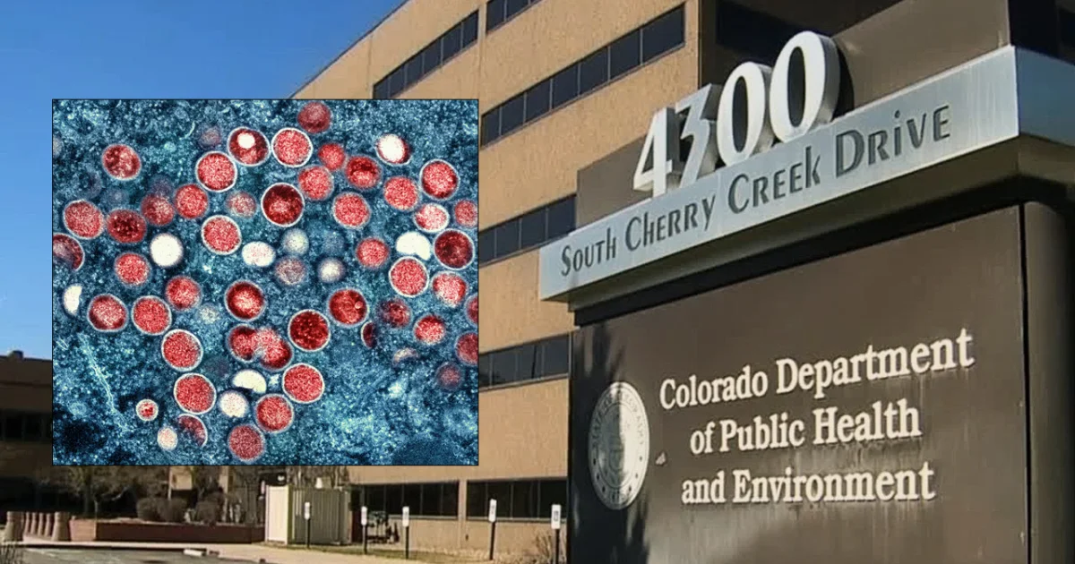 Colorado mpox uptick edges toward last year’s total