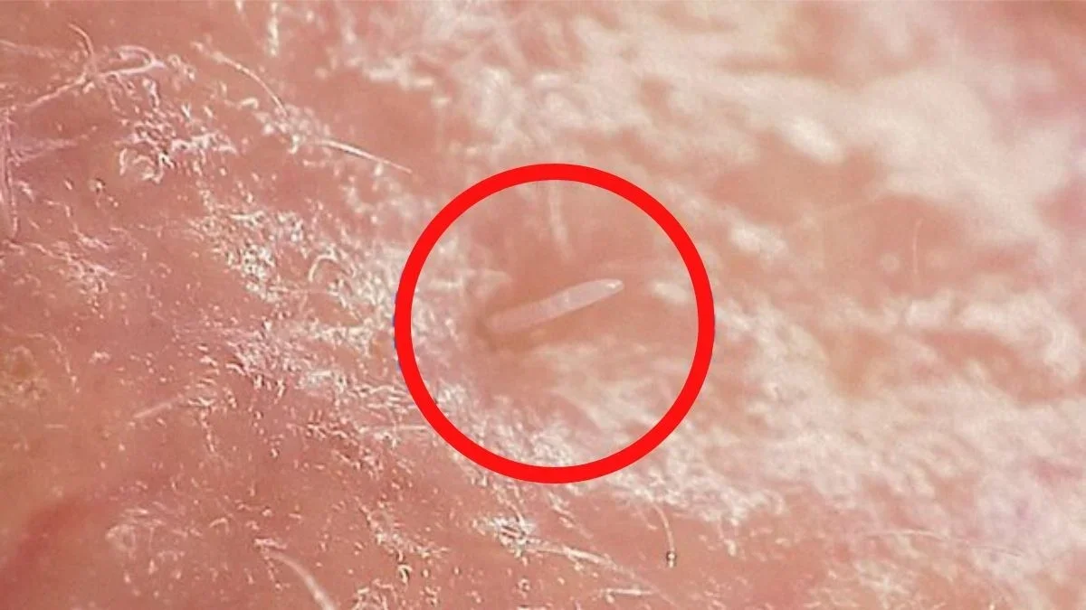Face Mites May Be Evolving Into a Symbiotic Partnership With Humans