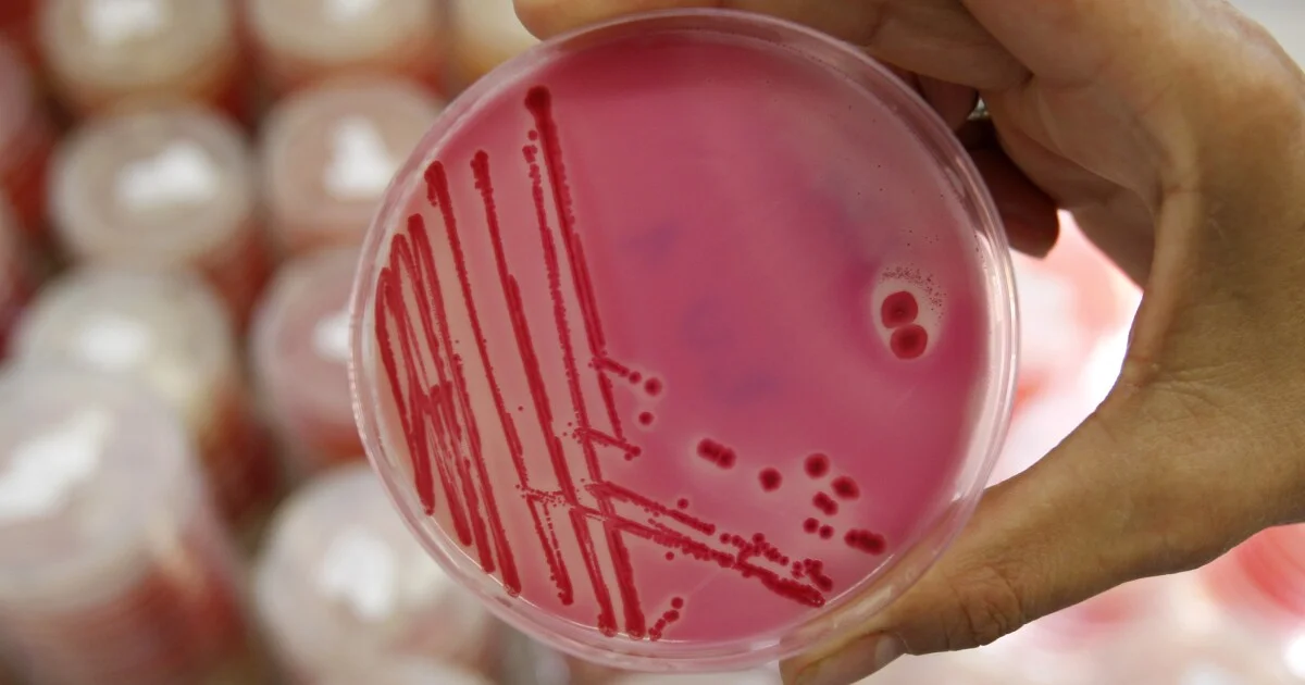 Colorado grapples with July surge in salmonella as investigators search for the source