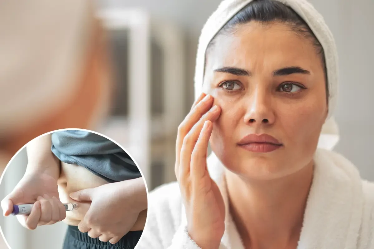 GLP-1 Weight-Loss Drugs Linked to Temporal Wasting and Older Looks