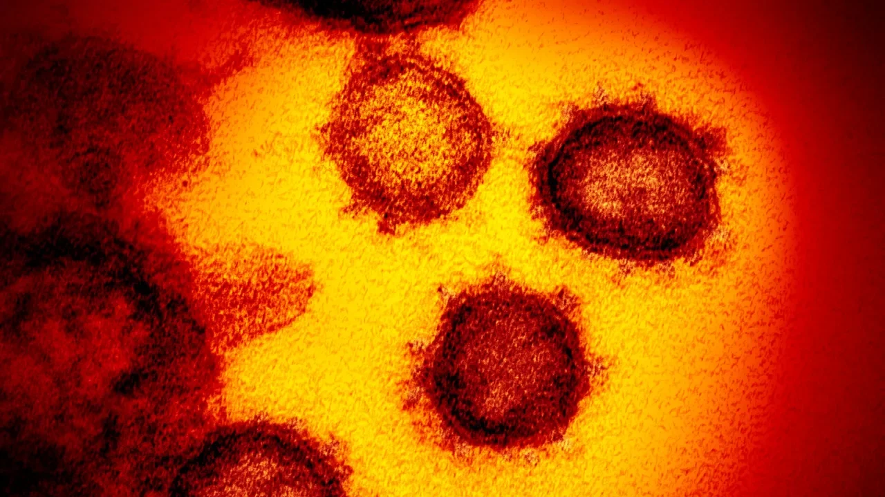 Surging COVID-19 Cases Sweep Across California and Virginia