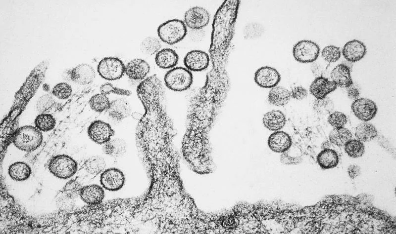 Hantavirus on cruise ship prompts seven cases, three deaths off Cabo Verde