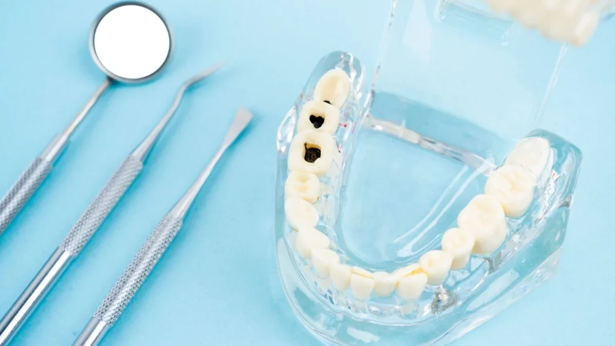 Liquid Fluoride Arrests Cavities in Young Children, Large Trial Finds