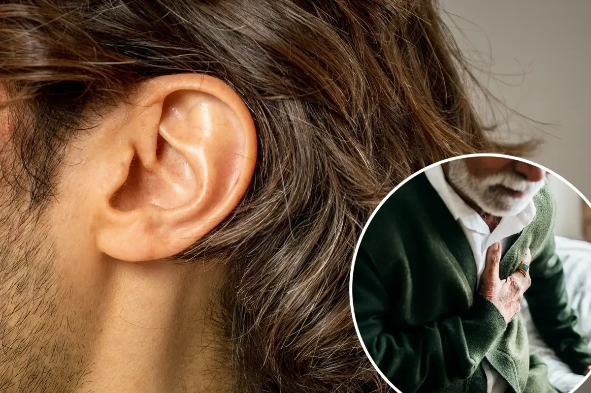 Ear crease linked to higher heart-disease risk, new research says
