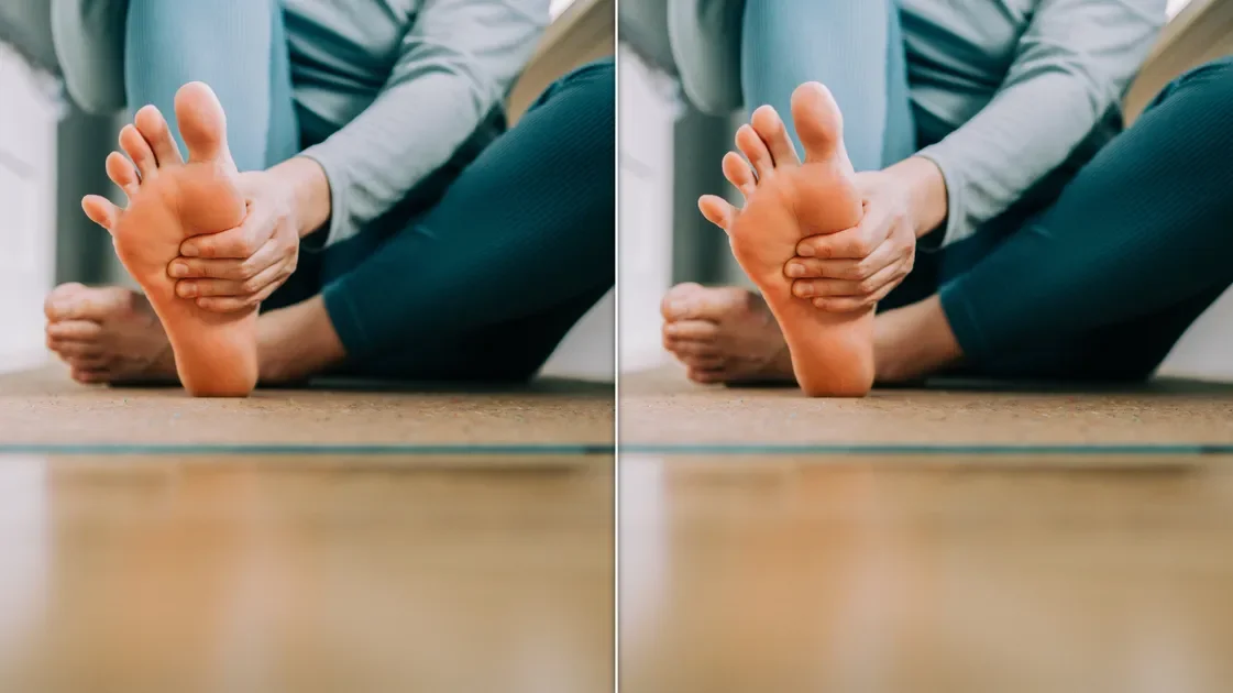 Flat Feet: When a Low Arch Signals Real Health Problems