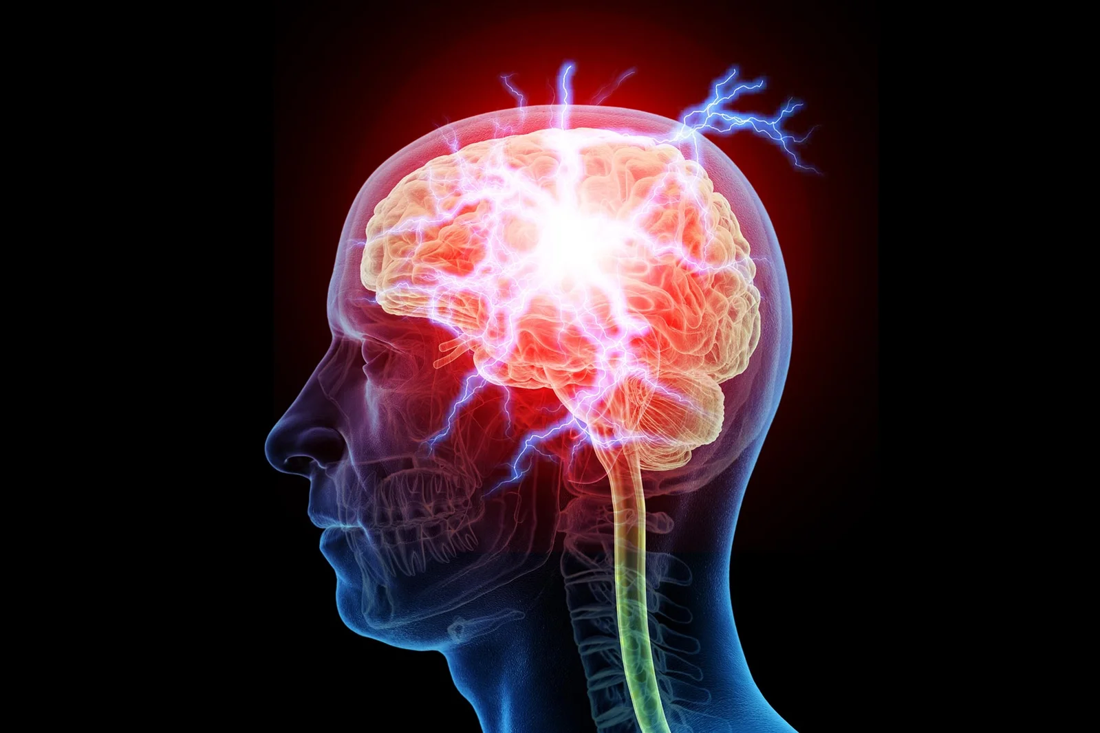 Brain Switch in the Hippocampus Dictates Pain-Related Depression Risk