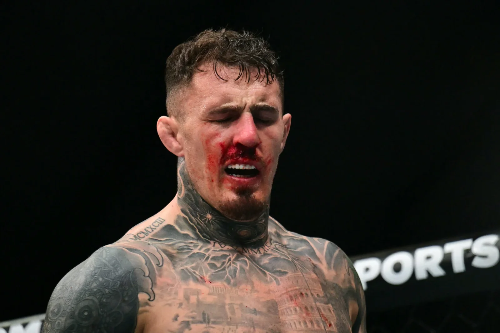 Aspinall’s UFC comeback hinges on medical clearance after eye injury