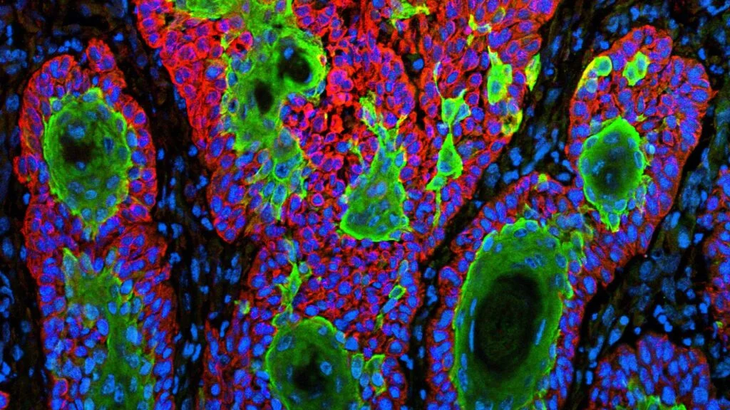 FDA Rejects Replimune’s Engineered Virus for Melanoma Again, Sparking Regulatory Debate