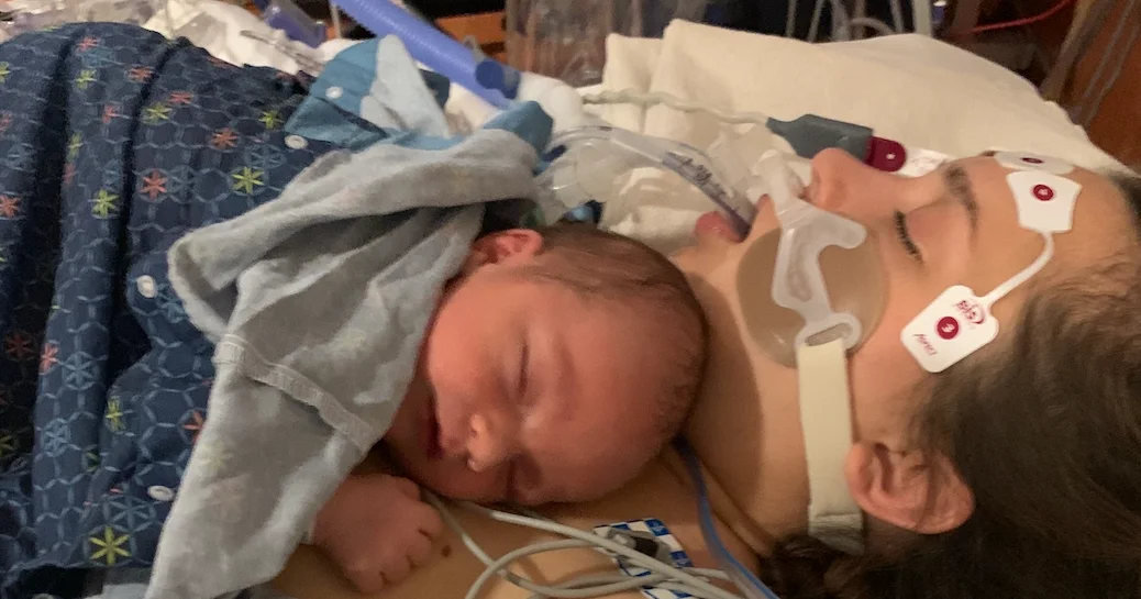 Emergency Heart Pump Saves Mom After Near-Fatal Labor Scare