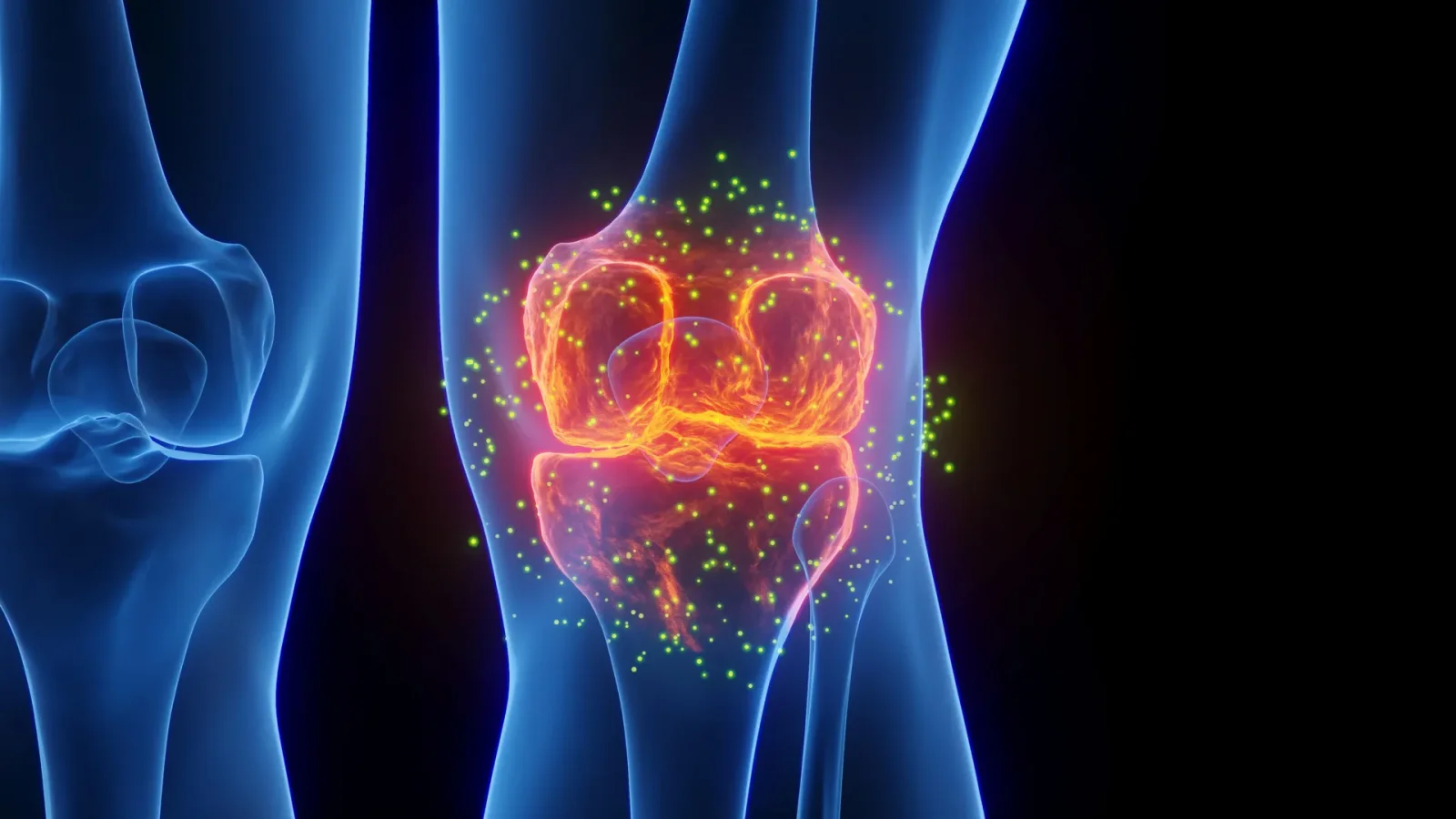 Aging-protein blocker regenerates knee cartilage, signaling arthritis reversal