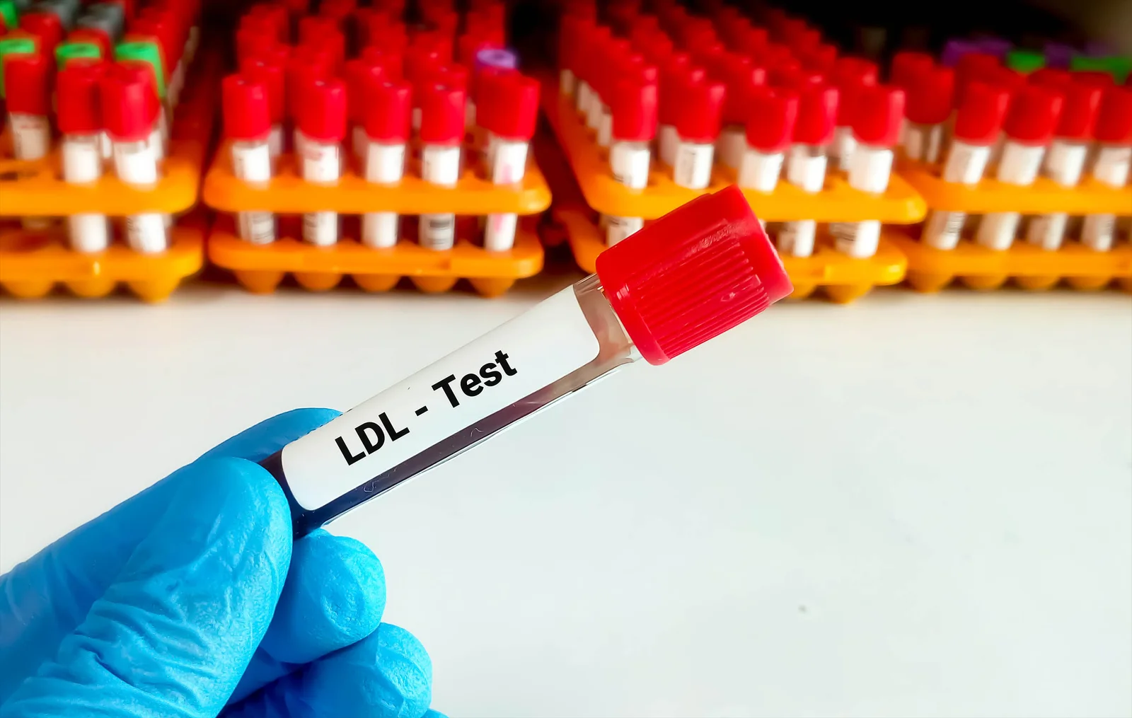 Lower LDL targets push earlier, risk-based heart prevention