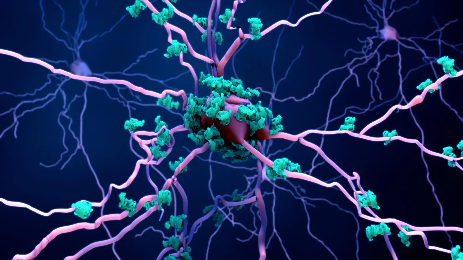 Karyoptosis: a nuclear-collapse death pathway linked to Alzheimer's and dementia