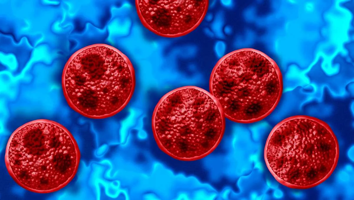 Hamilton County Sees New Cyclospora Cases as Outbreak Expands