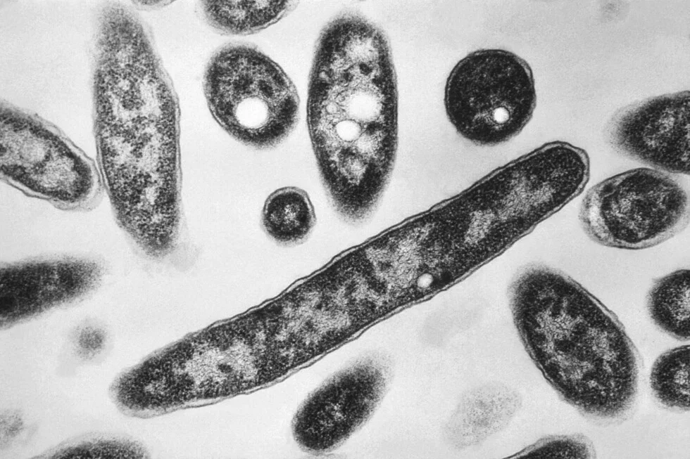 NYC Probes Legionnaires' Outbreak on the Upper East Side