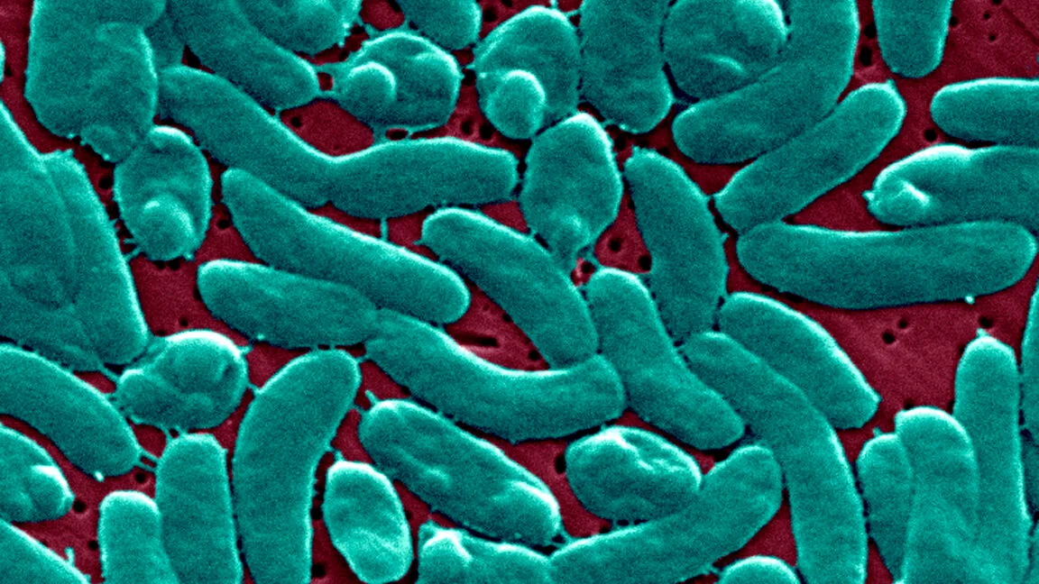 Warming Gulf Waters Spark Rapid Flesh-Eating Infection Requiring Amputation
