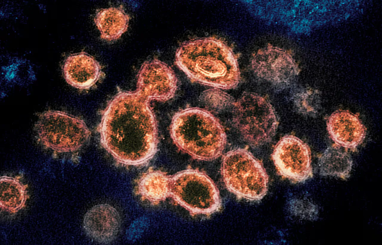 COVID-19 Cases Surge Across the Nation