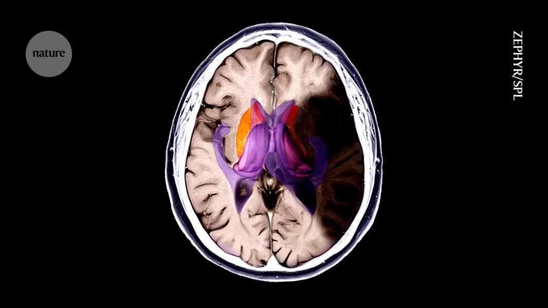 Cool combo shields mouse brains from stroke damage by slowing metabolism