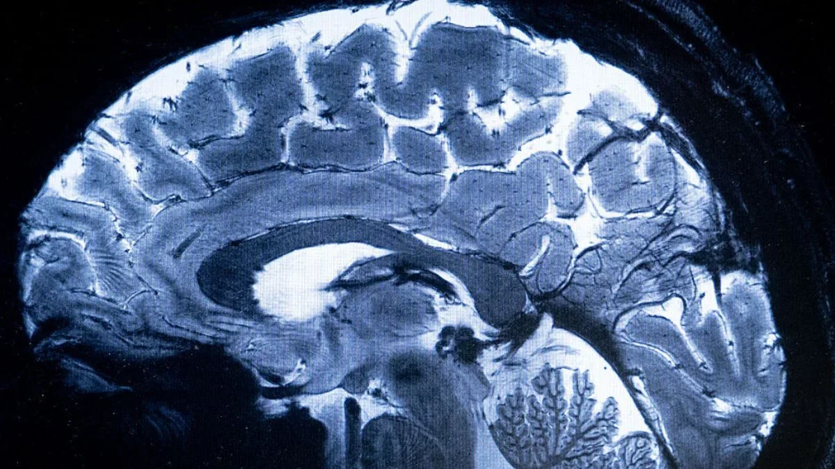 Midlife Brain Remodeling Rewrites Immune Landscape, Linking to Inflammation and Dementia Risk