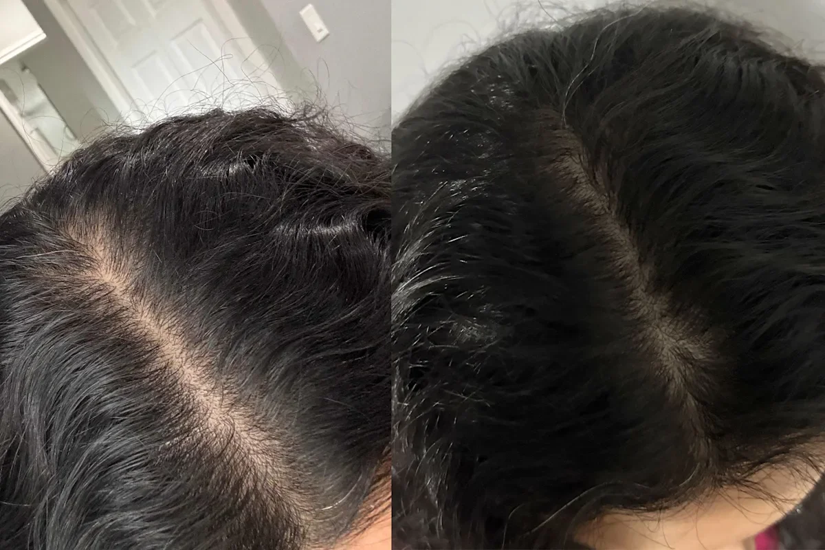 Women’s thinning hair decoded: expert tips and 13 science-backed products that actually help