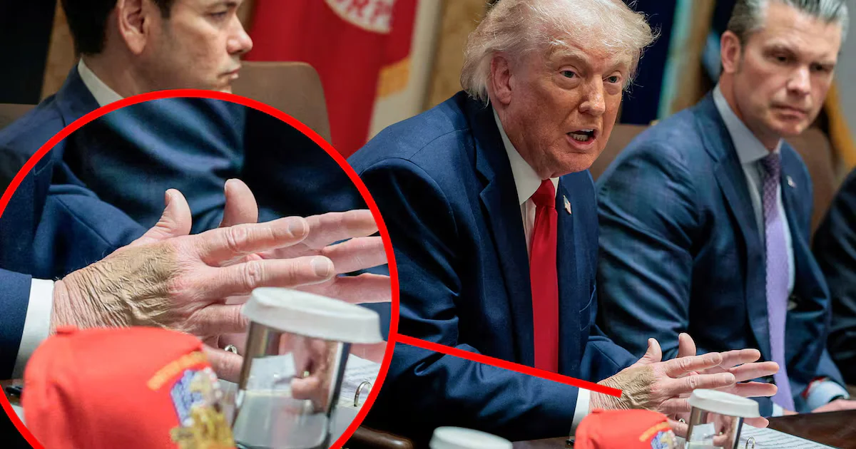 Trump Masks Bruised Hand After Hospital Visit at Cabinet Meeting