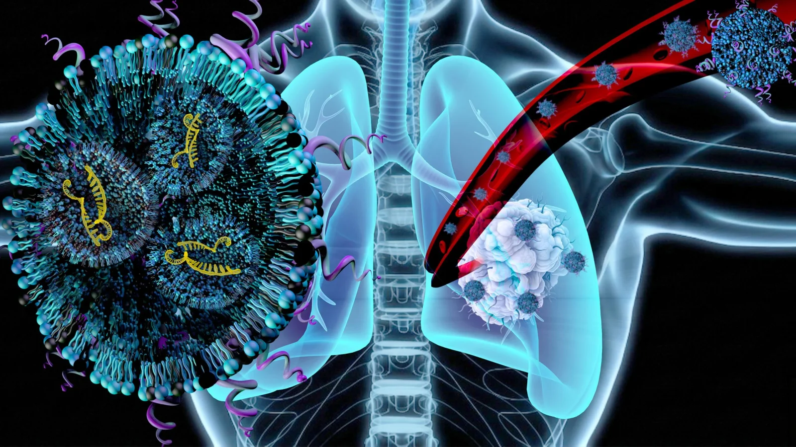 OSU’s Nanoparticles Target Lung Tumors and Muscle Wasting