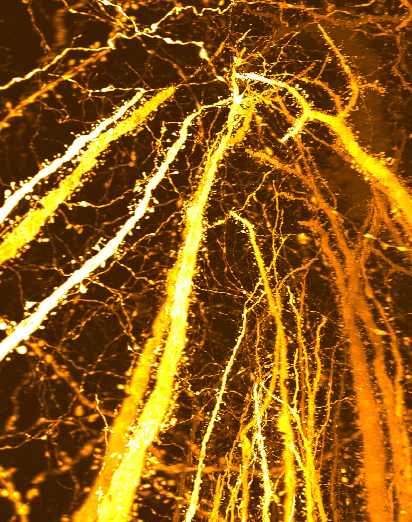 Adolescent Brain Builds Dense Synaptic Hotspots, Challenging Pruning Theory