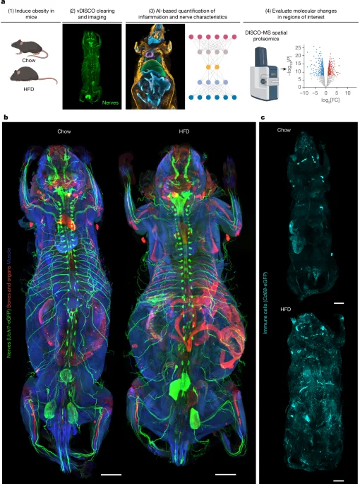 AI maps obesity-driven, body-wide cellular changes in mice with a three-part neural-immune-tissue framework