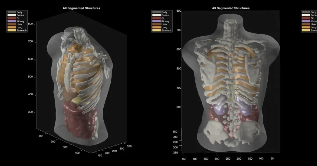 Midjourney Expands from AI Art to MRI-Style Full-Body Ultrasound Scans