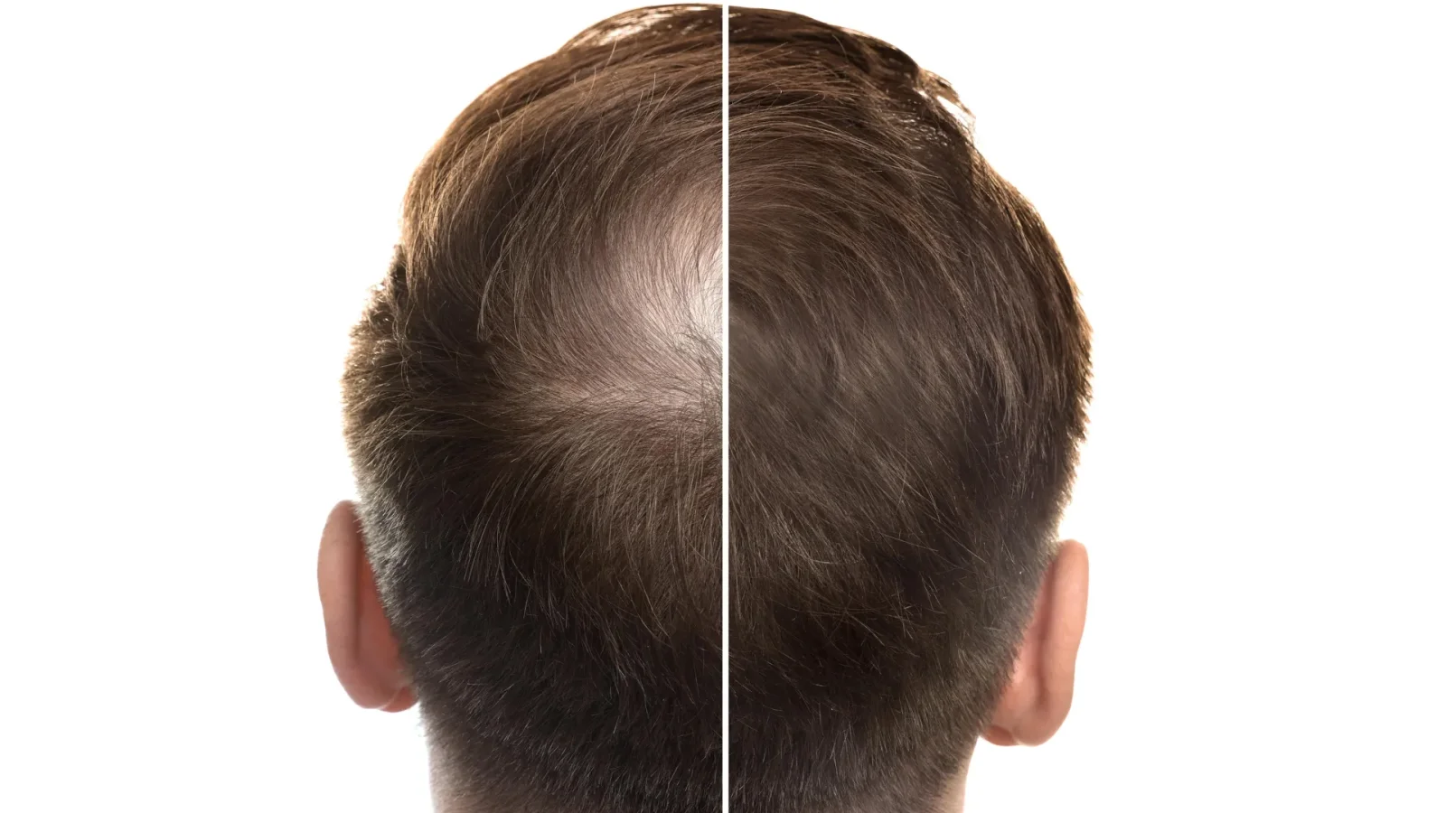Ancient Root May Combat Hair Loss Across Multiple Pathways