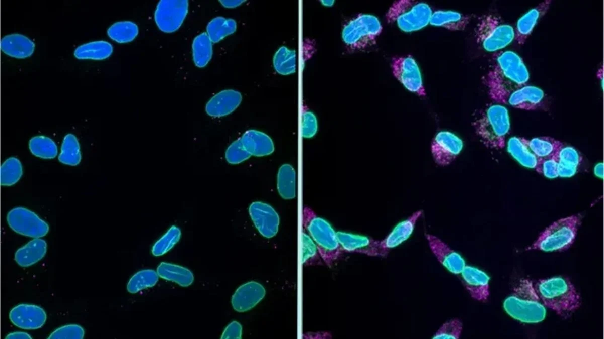 Nucleus collapse linked to dementia neuron death offers new therapy target