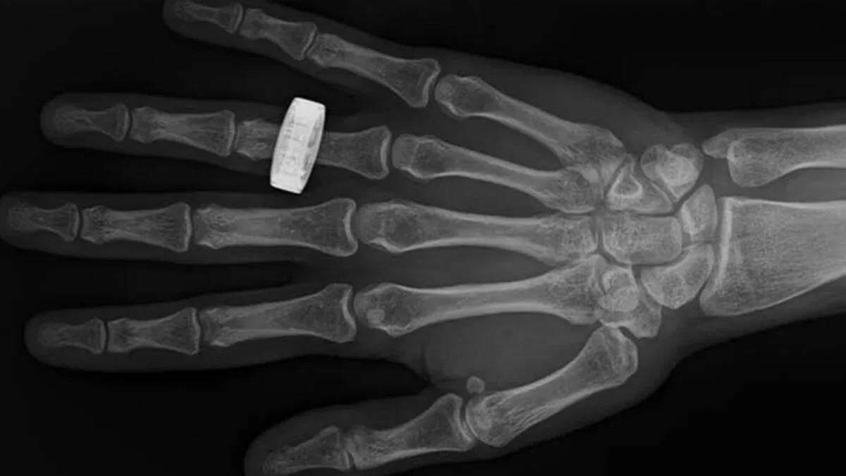 Orbiting X-Rays Break Ground in Space Medicine