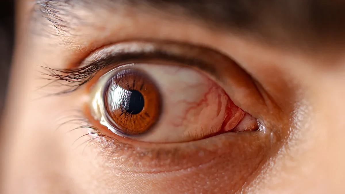 Spinach-Powered Eye Drops Harness Light to Fight Dry Eye