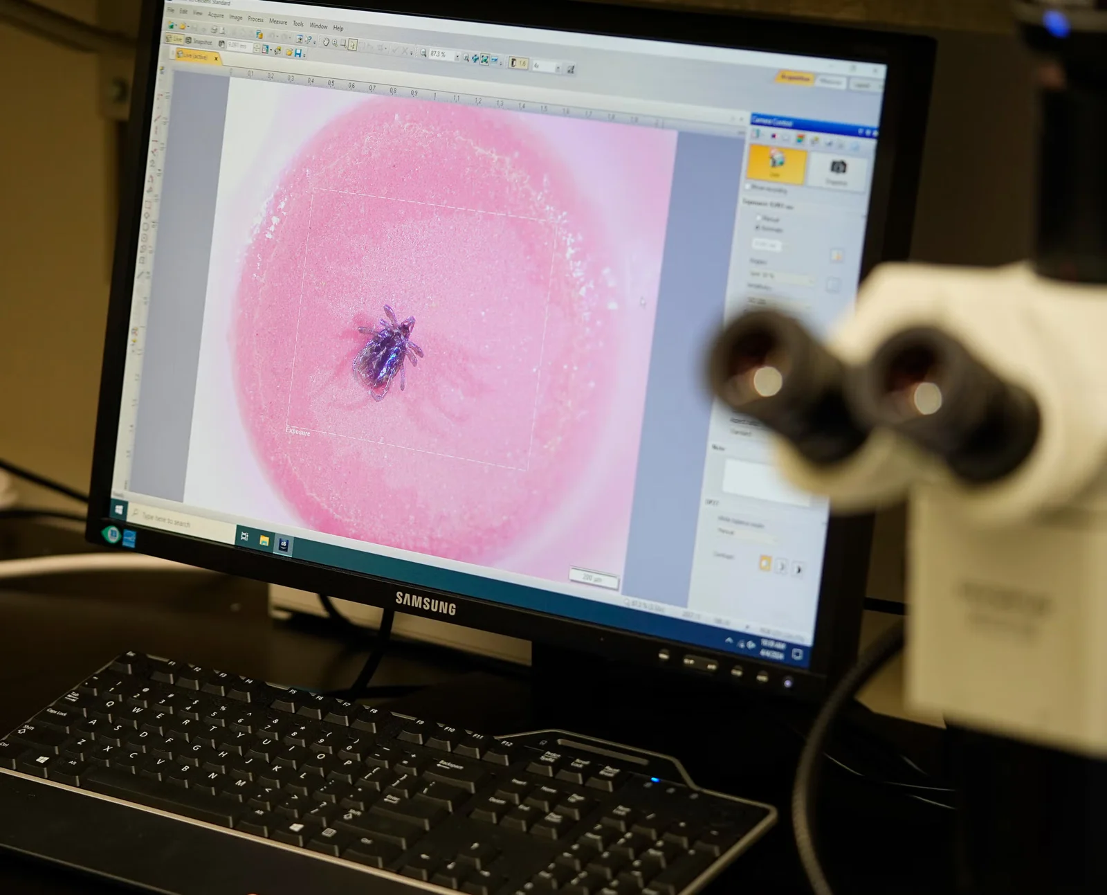 Wisconsin braces for a potentially big Lyme year as ticks surge