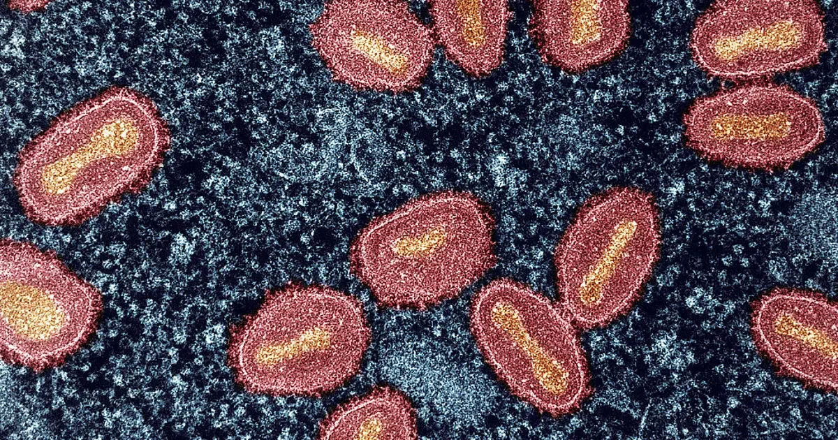 Wisconsin Reports Five mpox Cases, Urges Preventive Steps