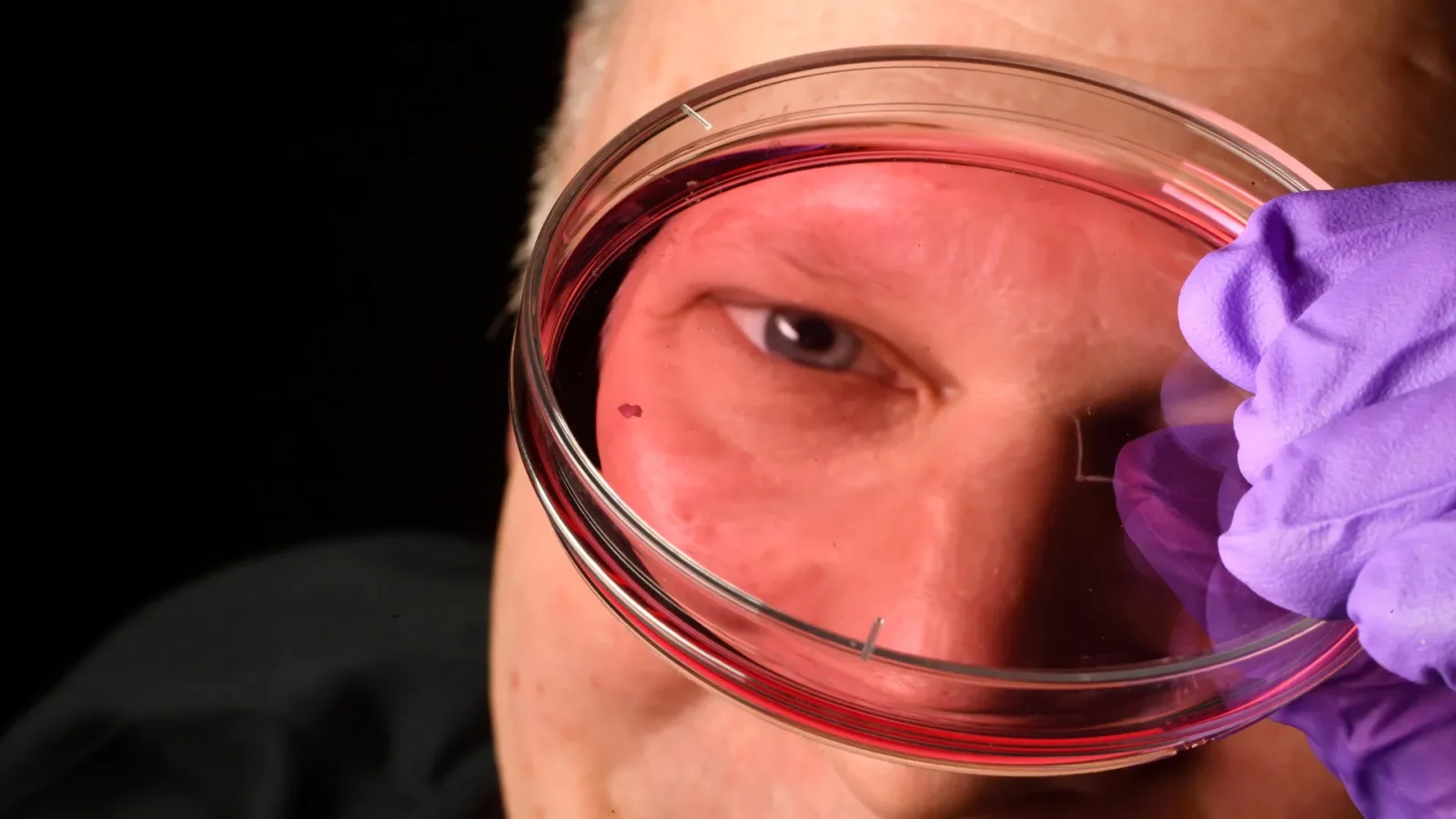 Vitamin A signals reshape how the eye forms sharp central vision