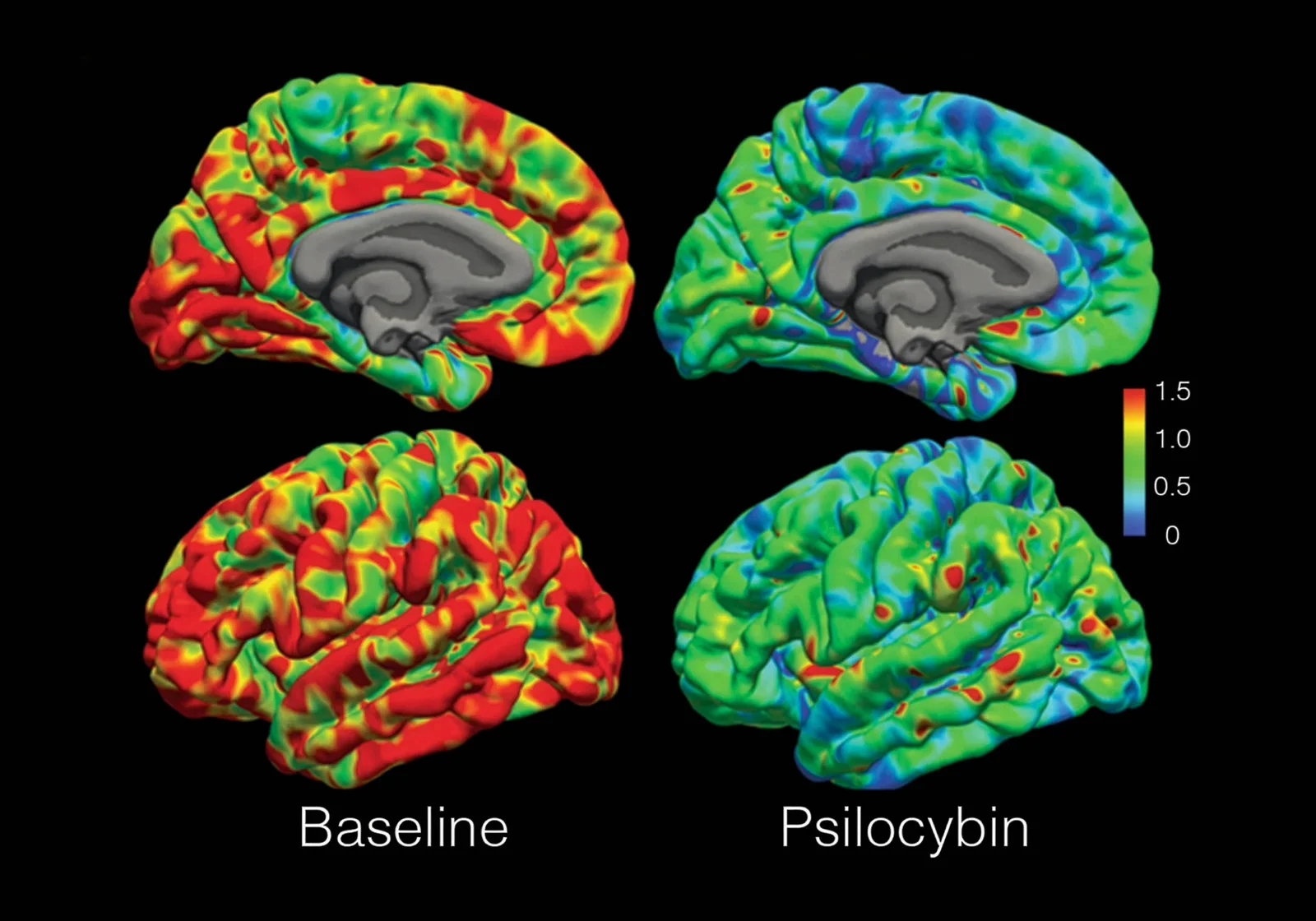 Five psychedelics converge on a common brain pattern, despite different chemistries
