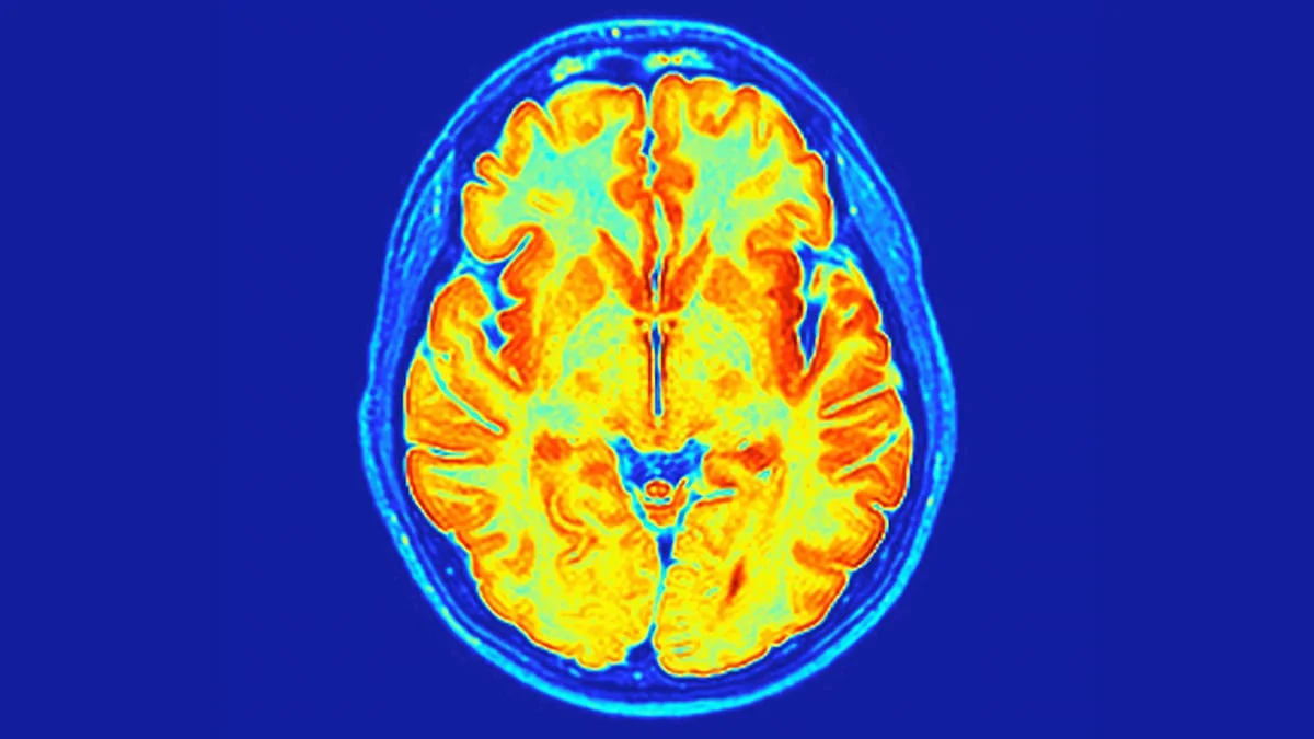 New ReNU2 Syndrome Emerges: A Non-Coding RNA Defect Driving Neurodevelopmental Disorder