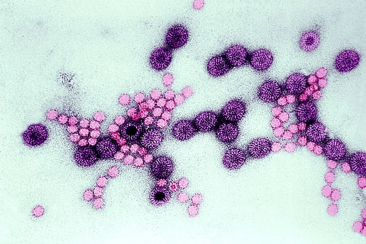 Bay Area braces for rotavirus uptick as World Cup crowds arrive