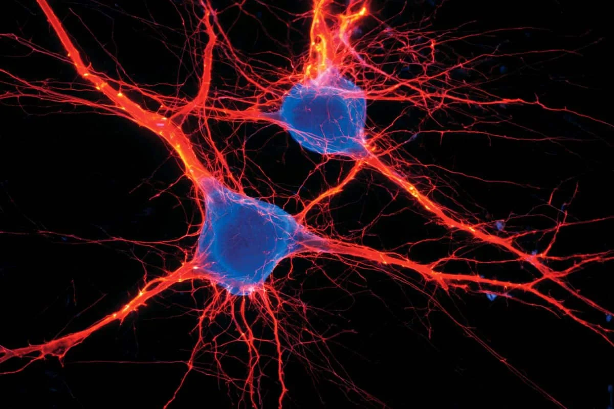 Tiny Brainstem Switch Triggers Week-Long Anxiety, Study Finds