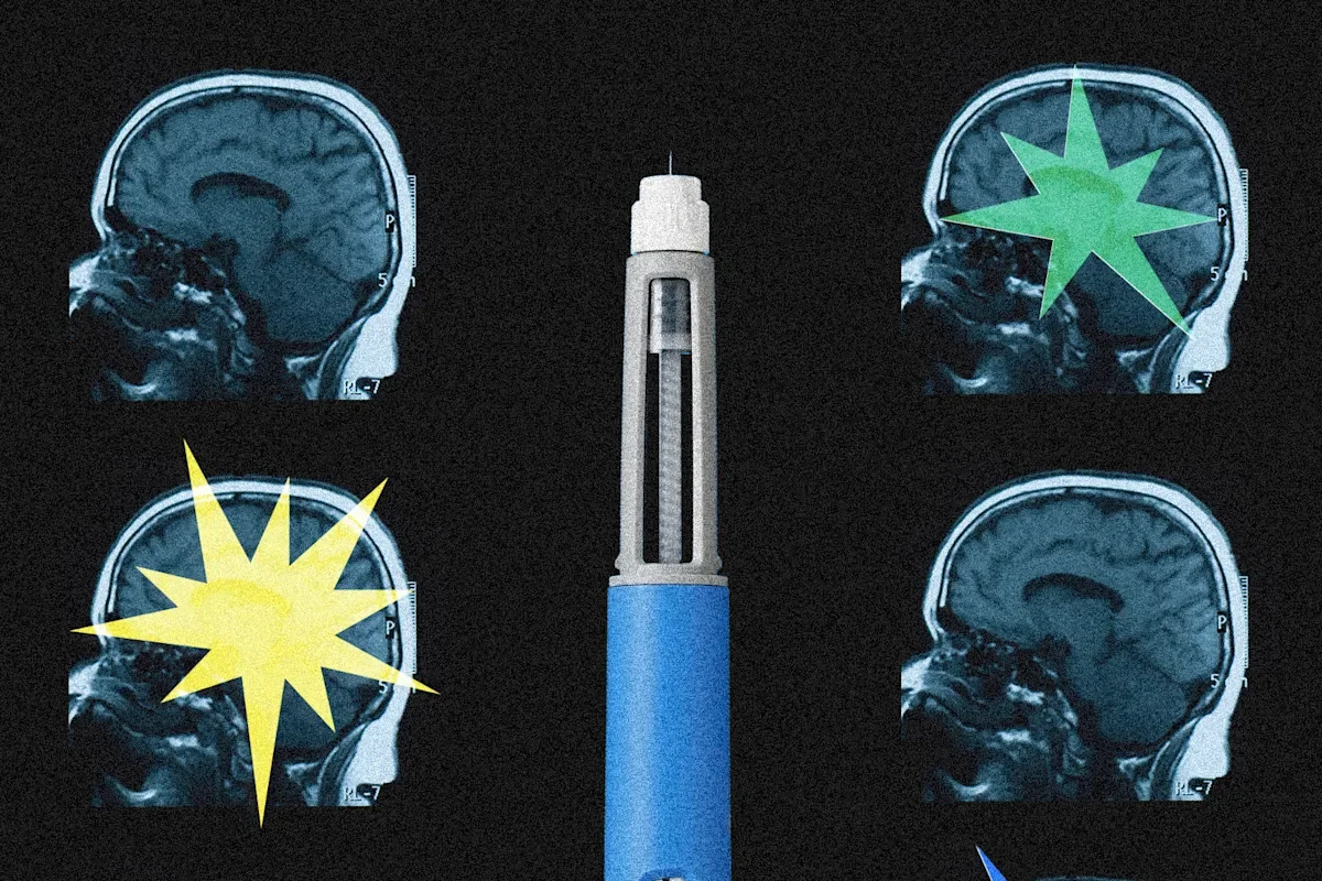Ozempic May Rewire the Brain, Changing Mood, Motivation and Cravings