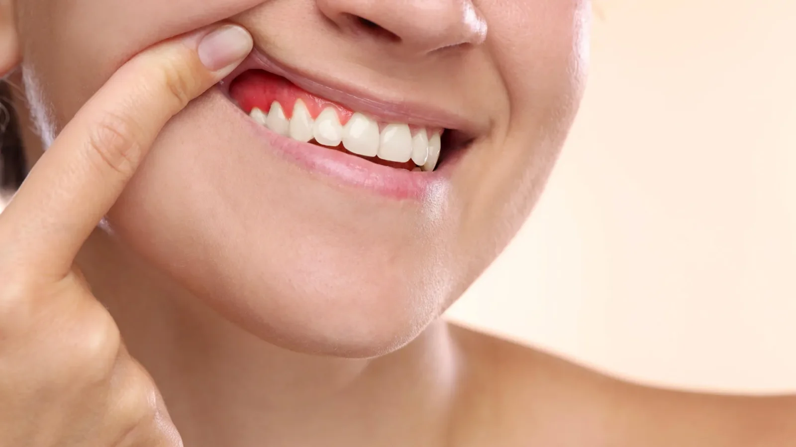 Jackfruit-derived gel could repair damage from gum disease