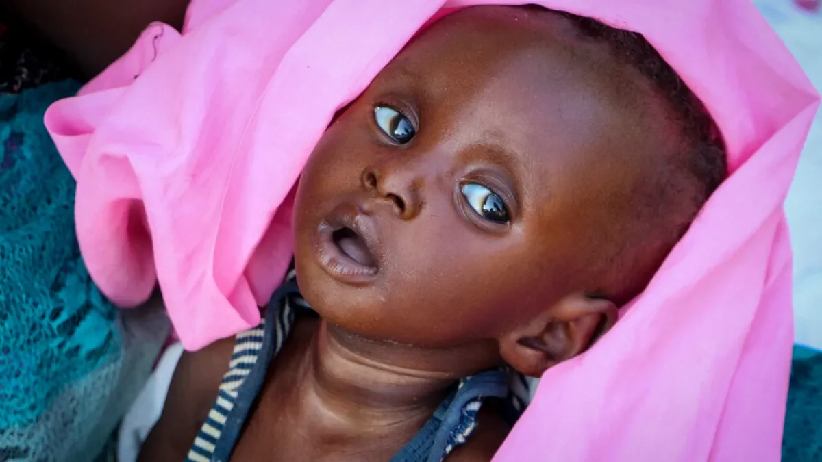South Sudan teeters on the brink of hunger as millions face acute malnutrition